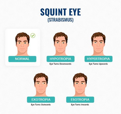 small_squint_eyes_2f8b61f542